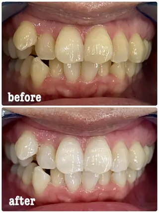 ホワイトニングサロン ラウレアのその他イメージ