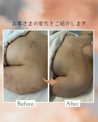 小滝 悠妃のネイルデザイン