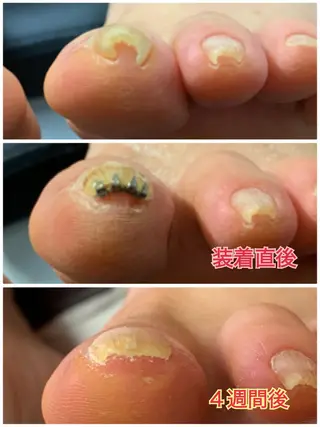 ネイル HANA │ネイルのネイルデザイン