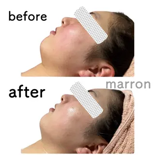 marron所属・痩身ハイパーナイフ ララピールリアボーテのエステ・リラクイメージ