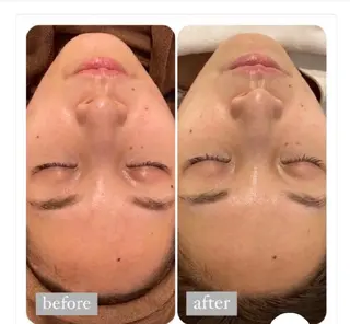 ハルモニア所属・エステハルモニア はるかのエステ・リラクイメージ