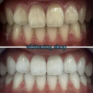 ホワイトニング ショップ浦和店のエステ・リラクイメージ