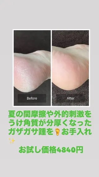 bloom ブルームのエステ・リラクイメージ