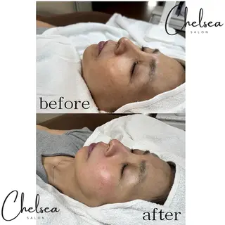 Chelsea所属・Chelsea 政　千尋のエステ・リラクイメージ