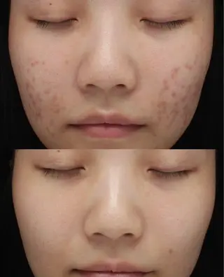 マツエク・マツパ 愛維美水光美肌専門店所属・愛維美水光美肌専門店 メンズレディースokのエステ・リラクイメージ