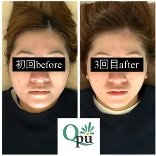 Qpu(キュープ)下北沢店所属・鮎川 さゆりのエステ・リラクイメージ