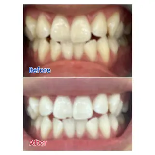 MBEAUTYSALON 千葉店・京成大久保所属・Melty 輝のその他イメージ