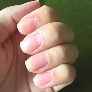 ネイル 深爪矯正/爪育成ケア manie nailのネイルデザイン