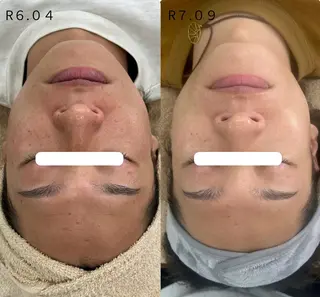 Venus所属・エステサロン Venusのその他イメージ