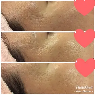 Une rencontre (ユヌ・ランコント)所属・つや肌専門店ユヌ・ ランコント中井のエステ・リラクイメージ