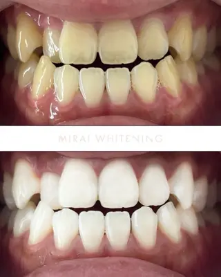 MIRAI WHITENING所属・ミライ ホワイトニングのエステ・リラクイメージ