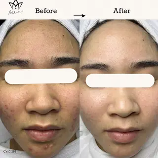 Mia beauty所属・MiA Beautyのエステ・リラクイメージ