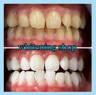 ホワイトニング ショップ千葉店のその他イメージ