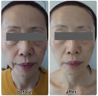 Esthe salon Blanche(エステサロンブランシュ)所属・小顔リフトアップ 美肌改善専門店のエステ・リラクイメージ