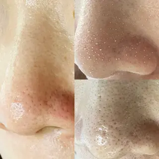 Rifuro毛穴ケア &よもぎ蒸しサロンのエステ・リラクイメージ