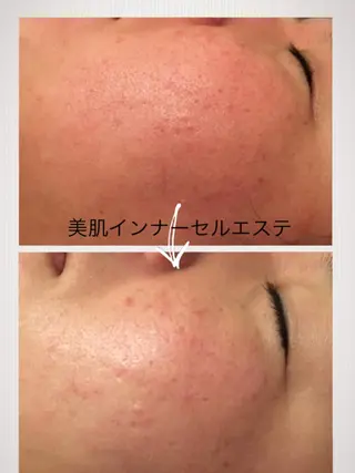 美筋骨格リンパ®️ Aroleのエステ・リラクイメージ