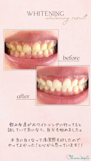 ホワイトニングサロンLuana-Sinfonia(エクシア)池袋店所属・セルフホワイトニング エクシア 池袋店のその他イメージ