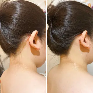 うなじ脱毛/美肌脱毛 LABELのエステ・リラクイメージ