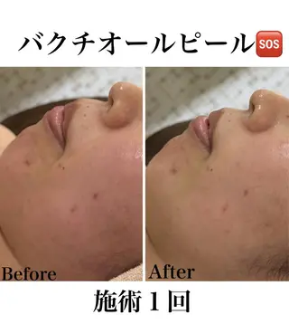 《美肌&小顔サロン》 Masqueradeのエステ・リラクイメージ