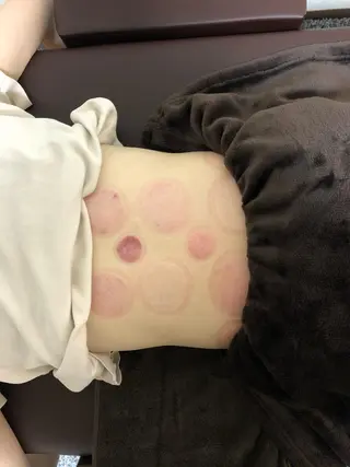 やはた鍼灸整骨院所属・やはた 鍼灸整骨院のエステ・リラクイメージ