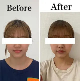 小顔と ヘッドスパのお店のエステ・リラクイメージ