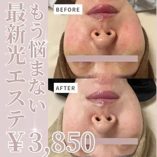 salon More所属・出口 玲菜のエステ・リラクイメージ