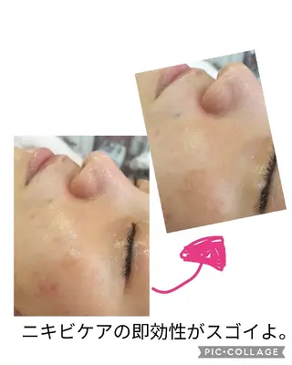 九鬼 瞳のエステ・リラクイメージ