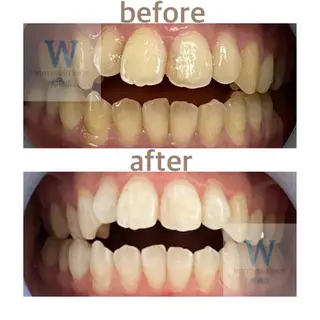 ホワイトニング ショップ船橋２号店のエステ・リラクイメージ