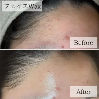 プライベート脱毛サロン　Arum所属・脱毛サロン Arumのエステ・リラクイメージ