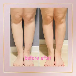 天満/asami/ 優しい筋膜リリースのエステ・リラクイメージ