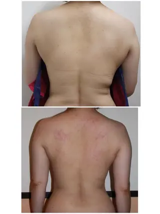 BeautySalonSoin所属・【医療提携エステ】 痩身専門Soinのエステ・リラクイメージ