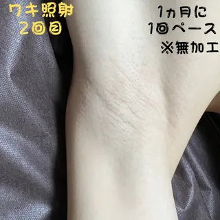 メンズ キッズ メンズ脱毛　FELISSE【フェリッセ】所属・メンズ脱毛フェリッセ /男女🆗キッズ🆗のエステ・リラクイメージ