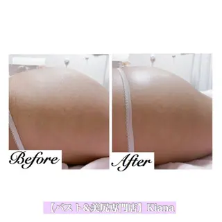 【バスト専門店 】 Kiana のエステ・リラクイメージ