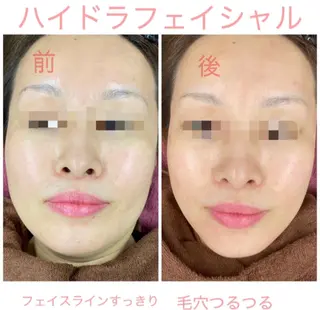 プリート毛穴洗浄美肌 Pulitoのエステ・リラクイメージ