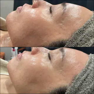 LiZA エステティックサロンのエステ・リラクイメージ