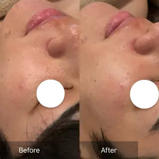 癒し&美活サロン COALALU麻布の眉毛・アイブロウイメージ