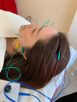 新宿hari-me所属・美容鍼hari-me 新宿のエステ・リラクイメージ