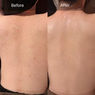 for woman所属・森 美優のエステ・リラクイメージ