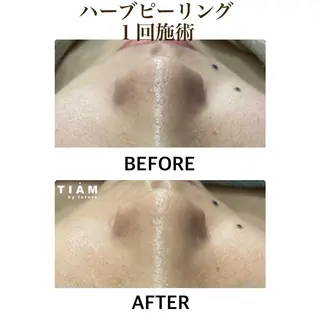 美肌サロンTIAM by tetoteのエステ・リラクイメージ