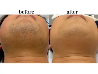 メンズ 瀬戸 梨子のエステ・リラクイメージ