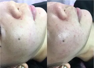 Fes Bonito❤所属・kawano shieriのエステ・リラクイメージ