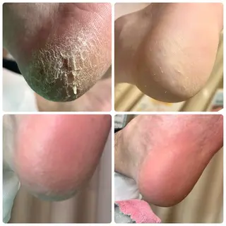 巻き爪補正店　柏店所属・巻き爪補正店 柏店のその他イメージ