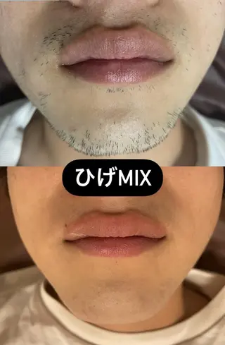 アイブロウ メンズ キッズ Epina 千葉店 【エピナ】のエステ・リラクイメージ