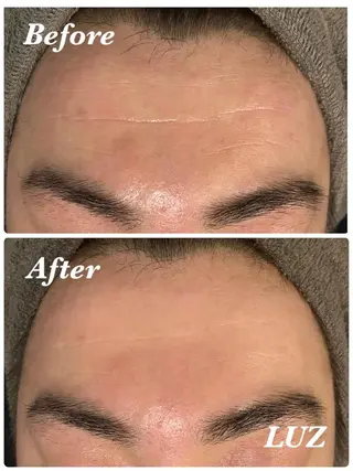 メンズ メンズフェイシャル アイブロウ・ルースのエステ・リラクイメージ