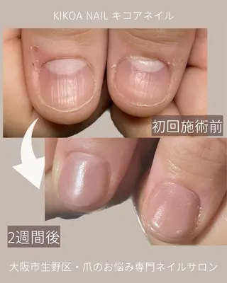 ネイル KIKOA NAIL キコアネイルのネイルデザイン