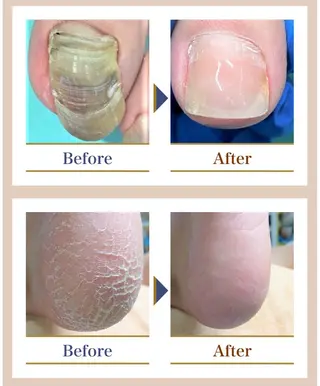 巻き爪補正店越谷店所属・巻き爪補正店 越谷店のネイルデザイン