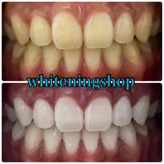 ホワイトニング ショップ吉祥寺店のエステ・リラクイメージ