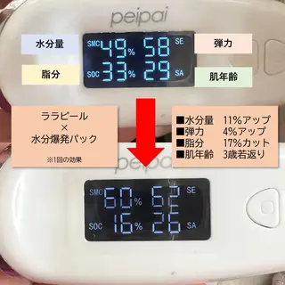 韓国美容専門店 LittleBlueのエステ・リラクイメージ