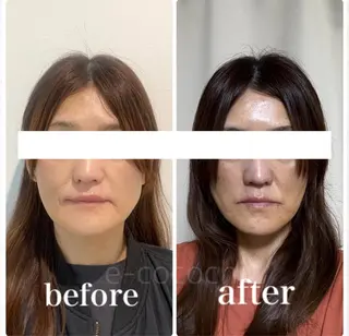 小顔と ヘッドスパのお店のエステ・リラクイメージ