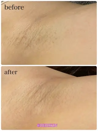 【痩身・脱毛サロン】 REBISKIN🌱のエステ・リラクイメージ